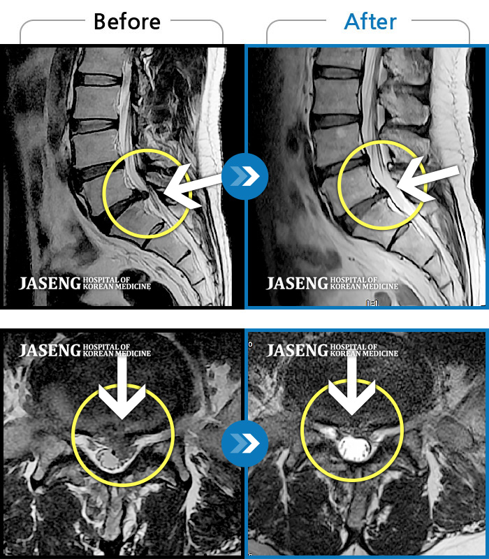 뱸ڻѹ溴 ġ MRI  ġ- ڼ   ġ, , Ƹ ĸ, , ߰   . 