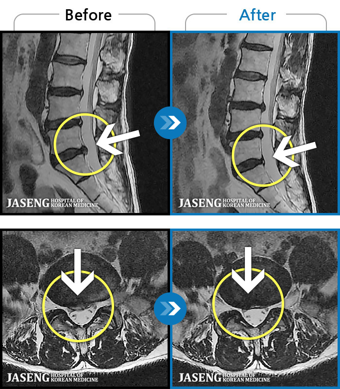 ڻѹ溴 ġ MRI ġ- ϰ ӵǾϴ. ߰ Ͽ ߰ Ǵ ߵ ̻ ȣϴ ¿ϴ.