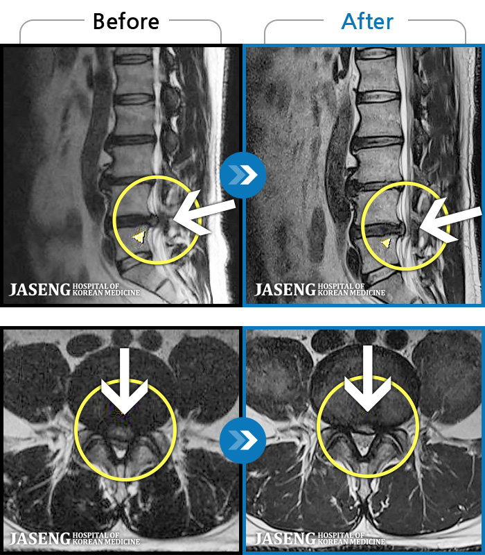 ڻѹ溴 ġ MRI ġ-㸮 ϰ , ̾ ϼ̽ϴ.