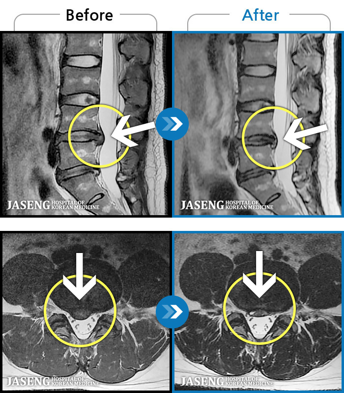 ڻѹ溴 ġ MRI ġ- 㸮