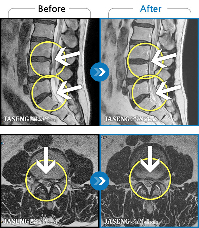 ڻѹ溴 ġ MRI ġ- 㸮 Ͽ ȴ ͵ · ϼ̽ϴ.