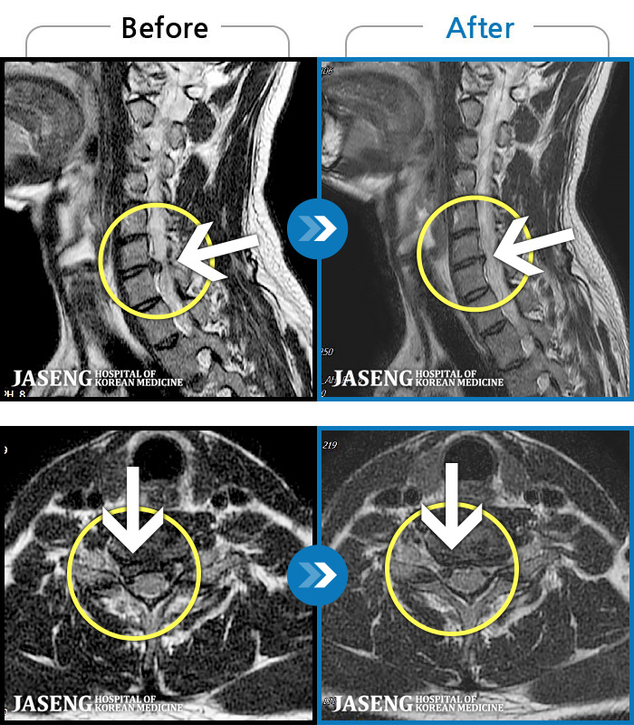 ڻѹ溴 ġ MRI ġ- Ͽϴ.