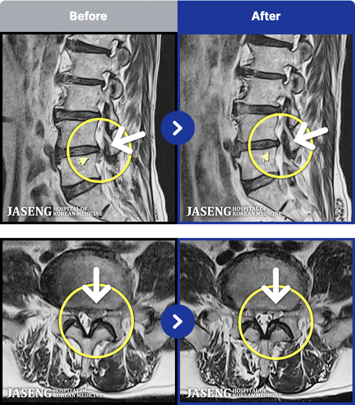 �����ڻ��ѹ溴�� ġ���� MRI�� ���� ġ����-��ð� �ɰų�, �Ͼ�� ���� �� ������ ���� ������ ��ݺ��� �߳����� Į�� °�� ���� ������ ���� ������ �־����ϴ�. 