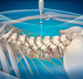 평촌자생한의원 허리치료법 신경근회복술-신경근회복술의 특징 두번째 관련 사진 입니다.