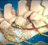 평촌자생한의원 허리치료법 신경근회복술-신경근회복술의 특징 네번째 관련 사진 입니다.