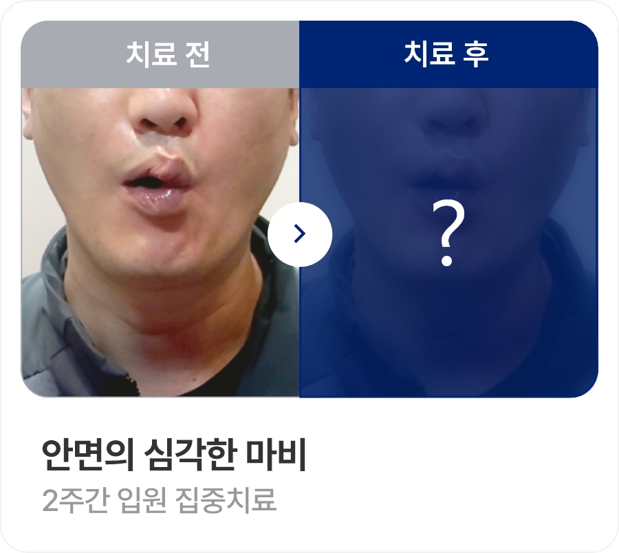 안면의 심각한 마비 / 2주간 입원 집중치료
