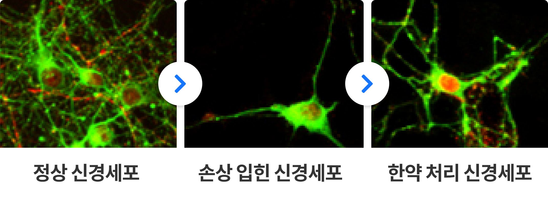 정상 신경세포, 손상 입힌 신경세포, 한약 처리 신경세포 비교